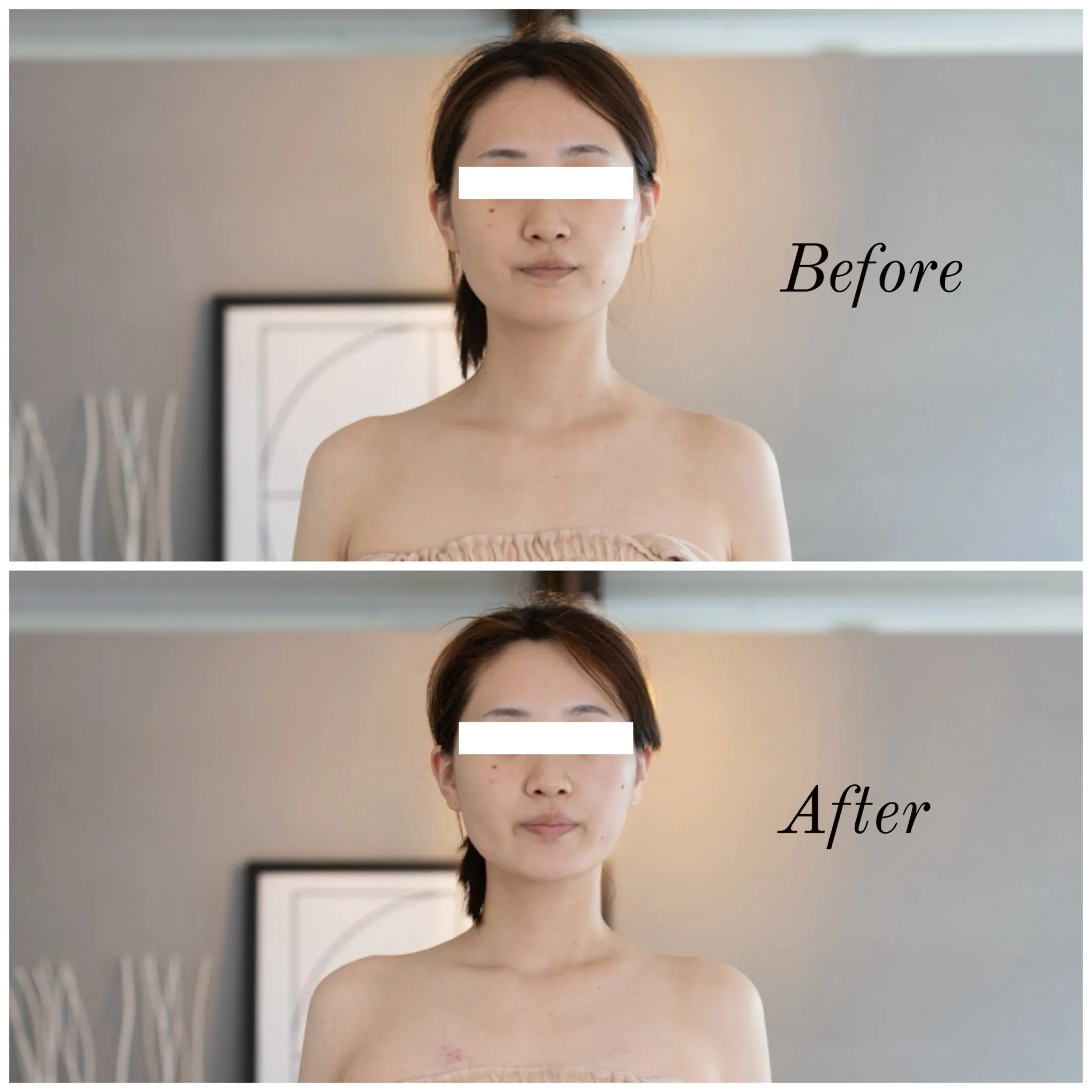 Before After①