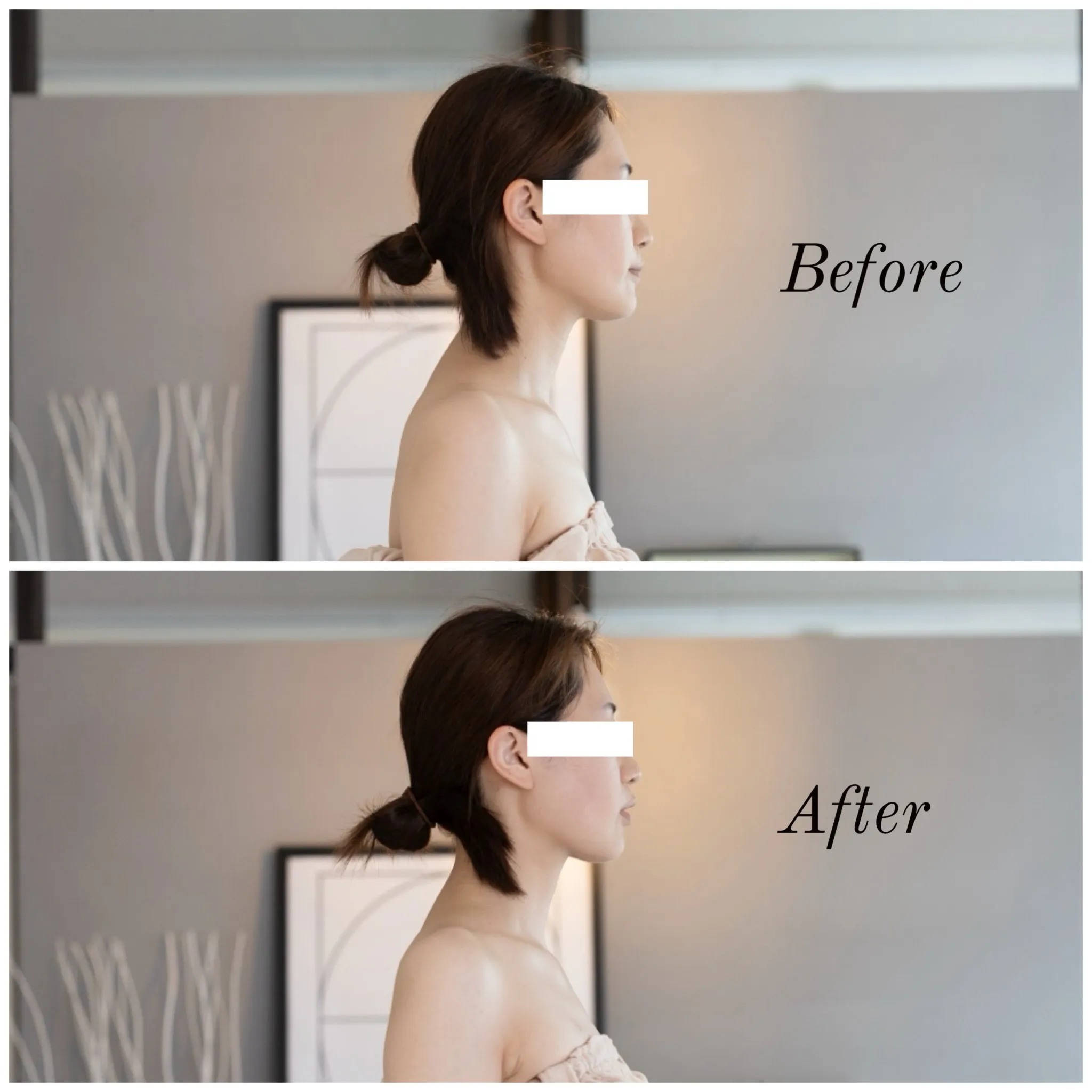 Before After③
