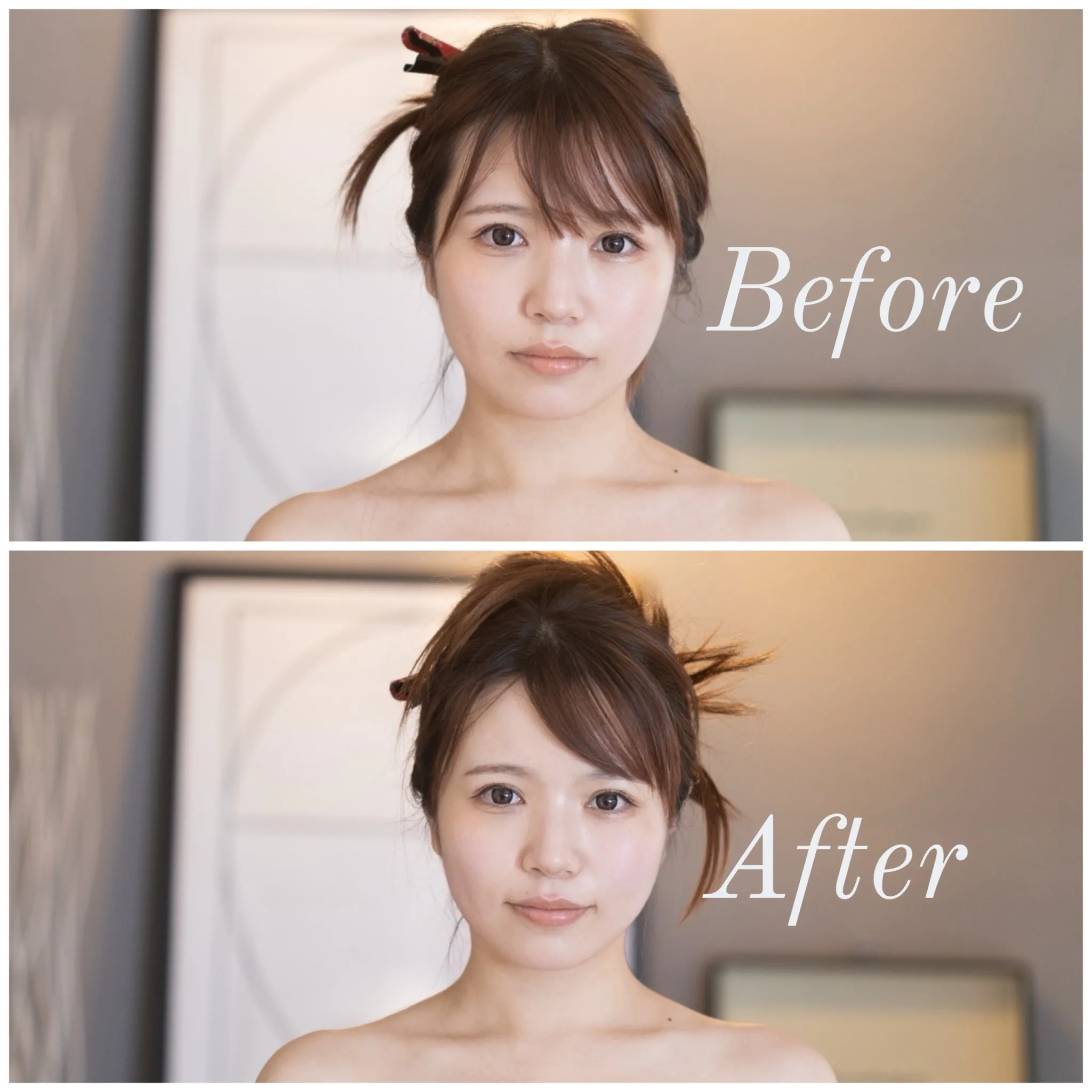 美容鍼のBefore After①