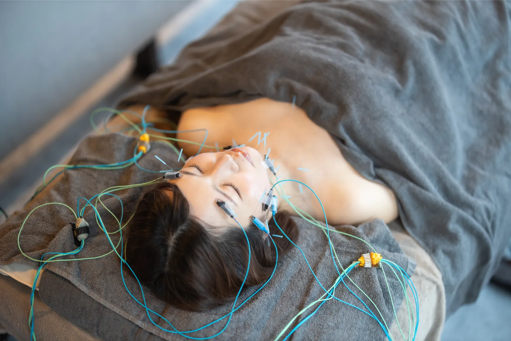 電気美容鍼